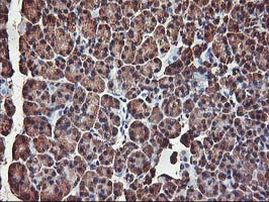 AKT1 Antibody in Immunohistochemistry (Paraffin) (IHC (P))