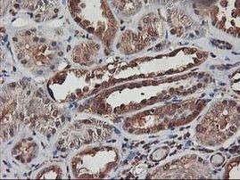 AKT1 Antibody in Immunohistochemistry (Paraffin) (IHC (P))