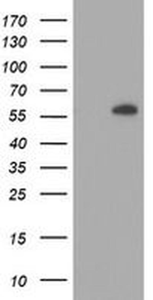 AKT1 Antibody in Western Blot (WB)