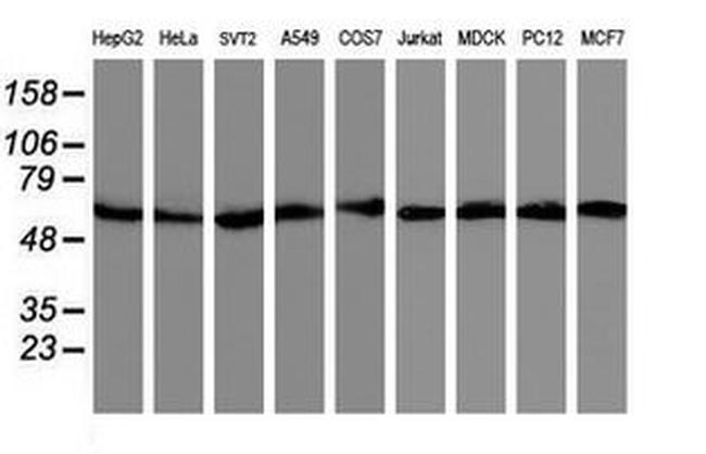 AKT1 Antibody in Western Blot (WB)