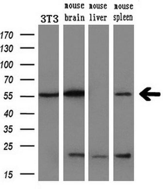 AKT1 Antibody in Western Blot (WB)