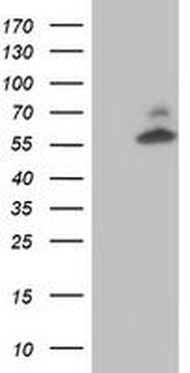 AKT1 Antibody in Western Blot (WB)