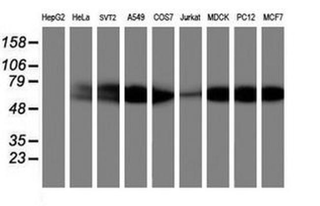 AKT1 Antibody in Western Blot (WB)