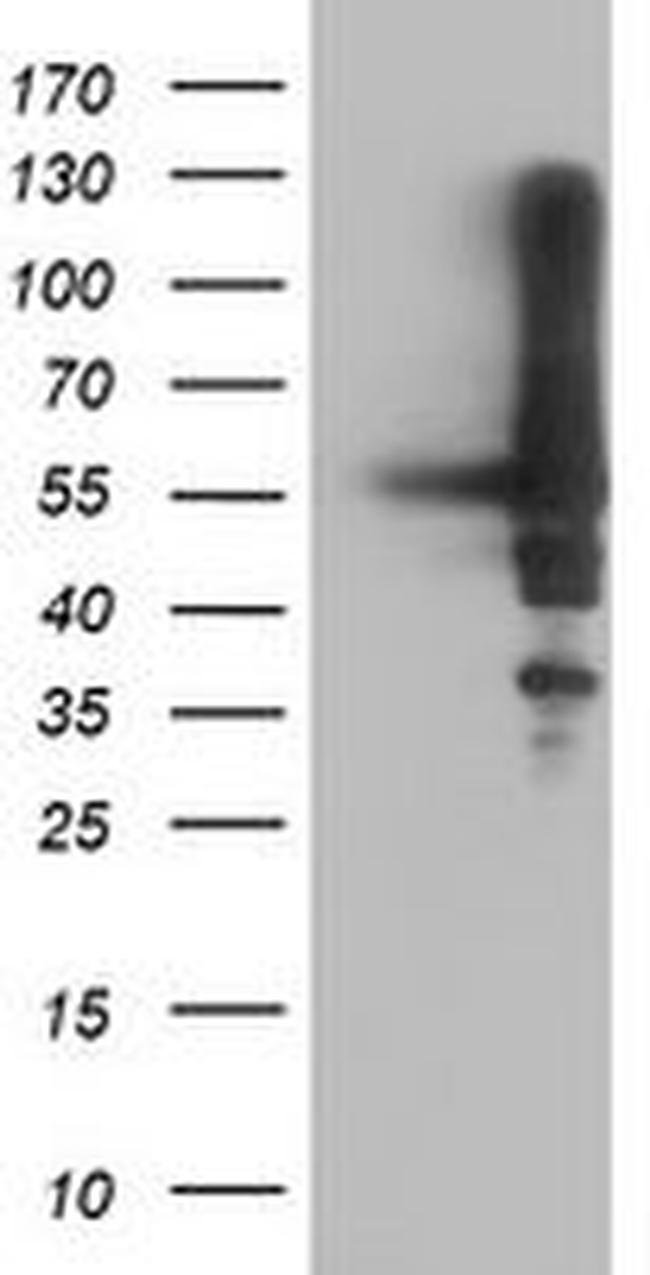 AKT1 Antibody in Western Blot (WB)