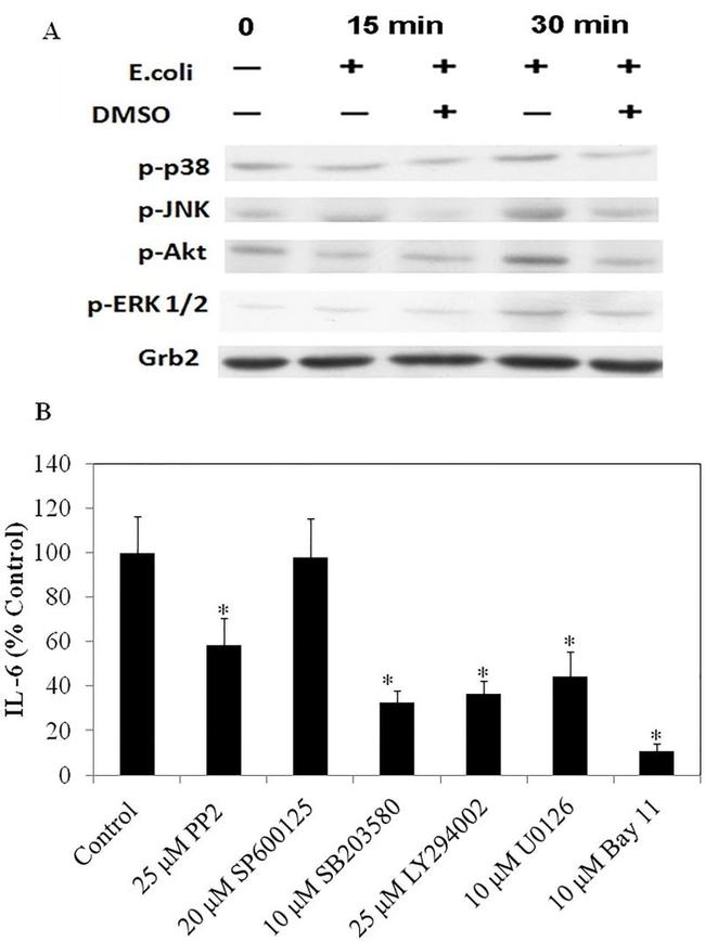 Phospho-AKT1 (Ser473) Antibody in Western Blot (WB)