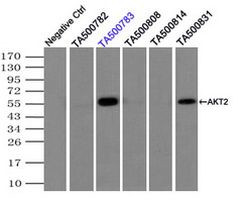 AKT2 Antibody in Immunoprecipitation (IP)