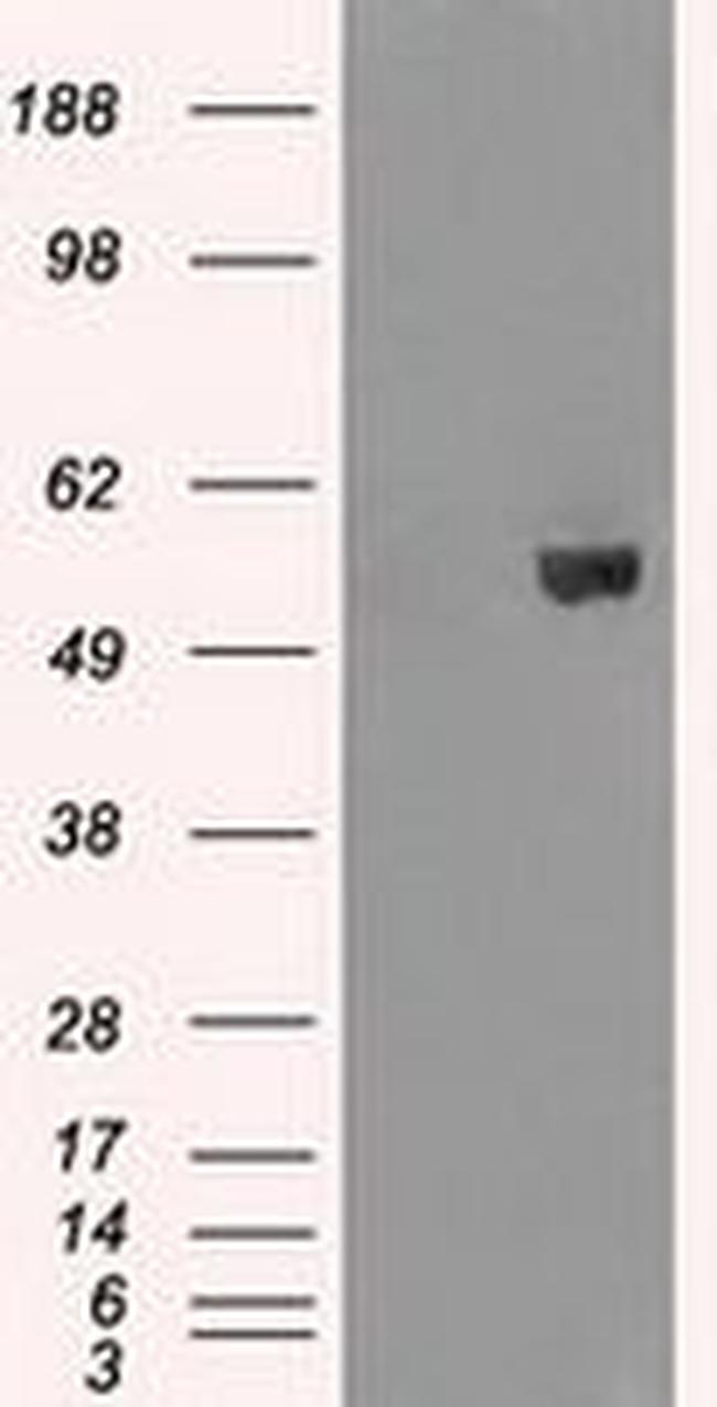 AKT2 Antibody in Western Blot (WB)