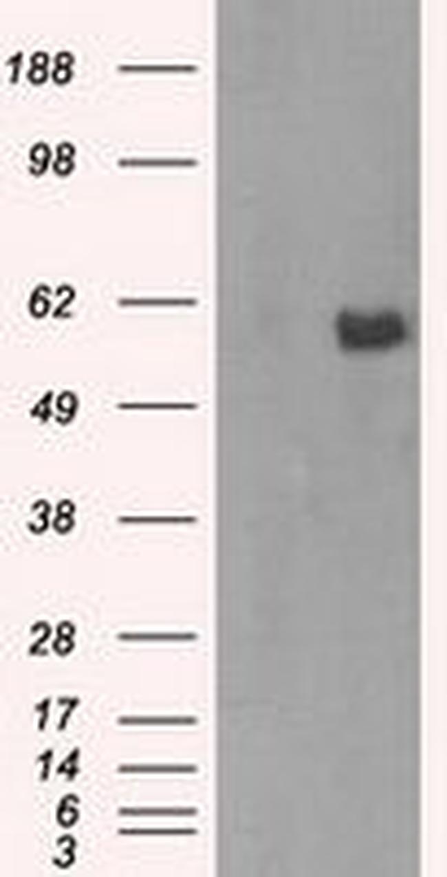 AKT2 Antibody in Western Blot (WB)