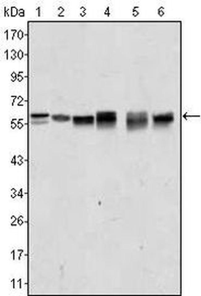 AKT2 Antibody in Western Blot (WB)