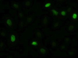 AKT3 Antibody in Immunocytochemistry (ICC/IF)