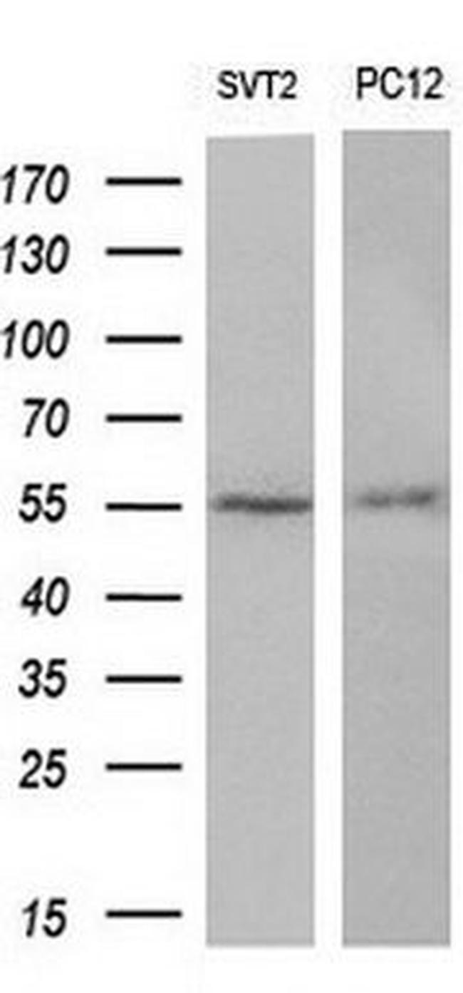 AKT3 Antibody in Western Blot (WB)