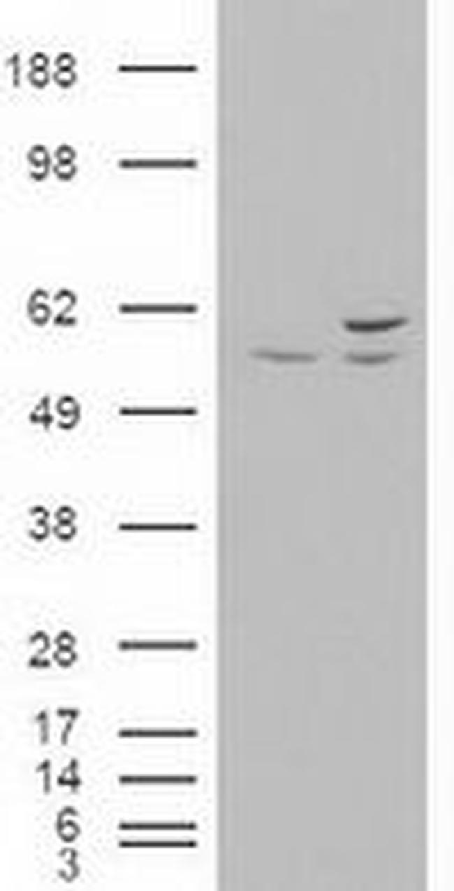 AKT3 Antibody in Western Blot (WB)