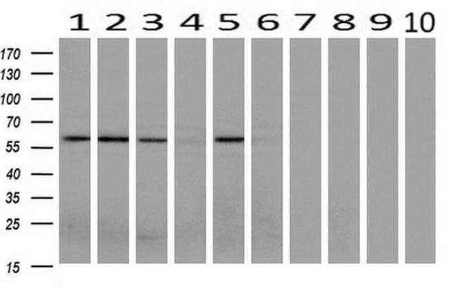 AKT3 Antibody in Western Blot (WB)