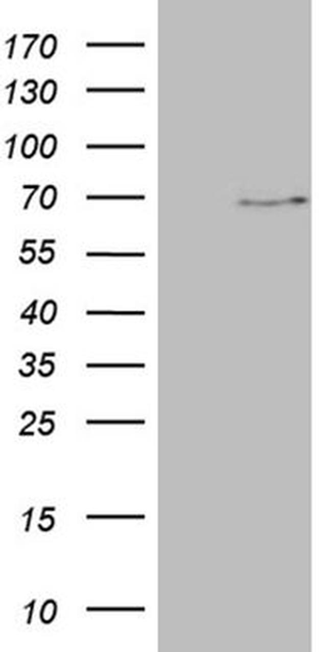 ALAS2 Antibody in Western Blot (WB)