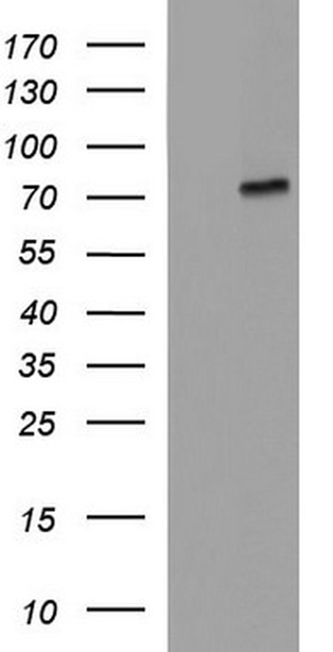 ALB Antibody in Western Blot (WB)