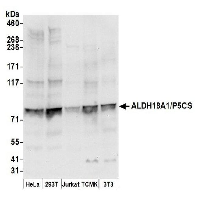 ALDH18A1/P5CS Antibody in Western Blot (WB)