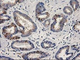 ALDH1A3 Antibody in Immunohistochemistry (Paraffin) (IHC (P))