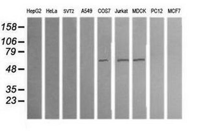 ALDH1A3 Antibody in Western Blot (WB)