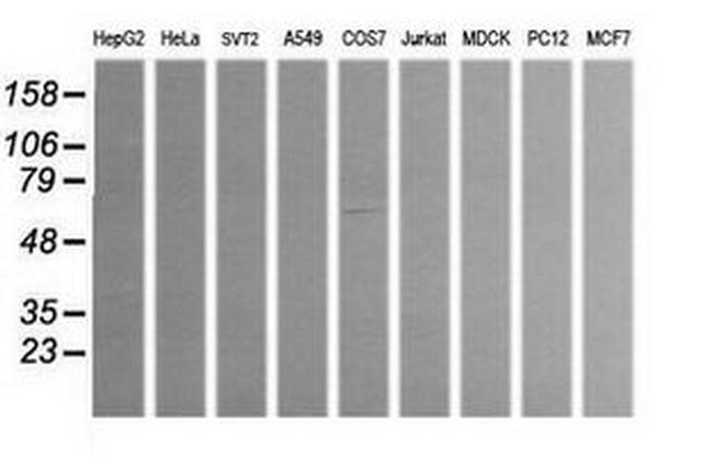 ALDH1A3 Antibody in Western Blot (WB)