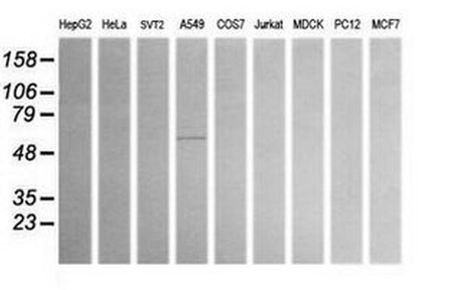 ALDH1A3 Antibody in Western Blot (WB)