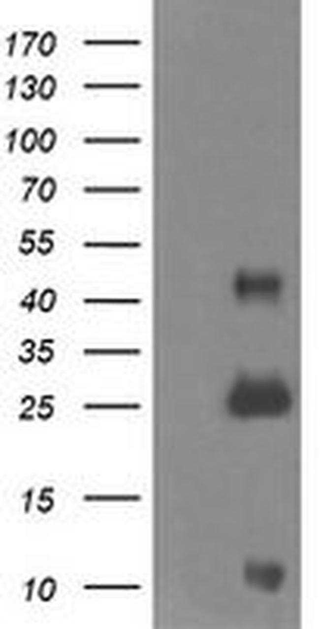 ALDH1A3 Antibody in Western Blot (WB)