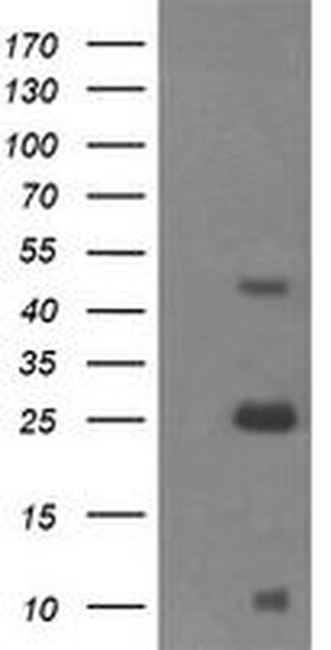 ALDH1A3 Antibody in Western Blot (WB)