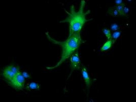 ALDH1L1 Antibody in Immunocytochemistry (ICC/IF)