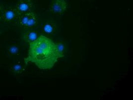 ALDH1L1 Antibody in Immunocytochemistry (ICC/IF)