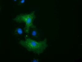 ALDH1L1 Antibody in Immunocytochemistry (ICC/IF)