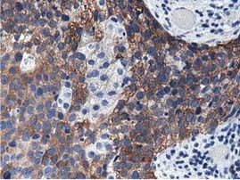 ALDH1L1 Antibody in Immunohistochemistry (Paraffin) (IHC (P))