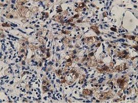 ALDH1L1 Antibody in Immunohistochemistry (Paraffin) (IHC (P))