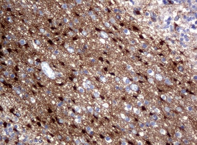 ALDH1L1 Antibody in Immunohistochemistry (Paraffin) (IHC (P))