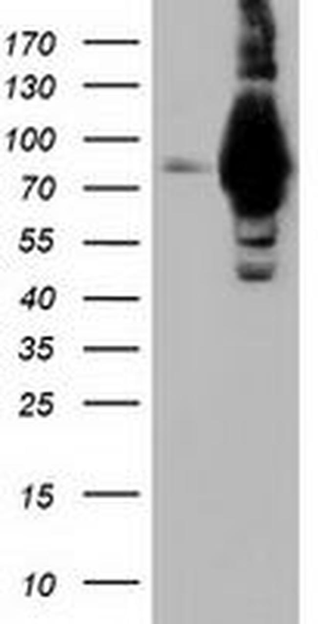 ALDH1L1 Antibody in Western Blot (WB)