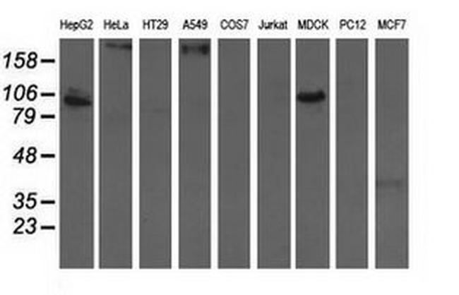 ALDH1L1 Antibody in Western Blot (WB)