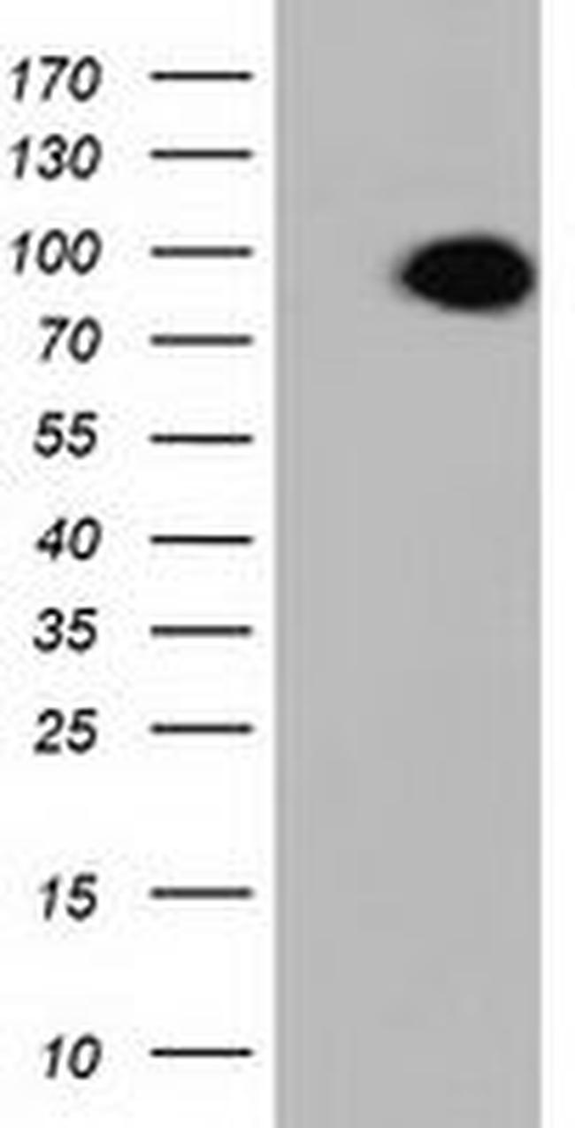 ALDH1L1 Antibody in Western Blot (WB)