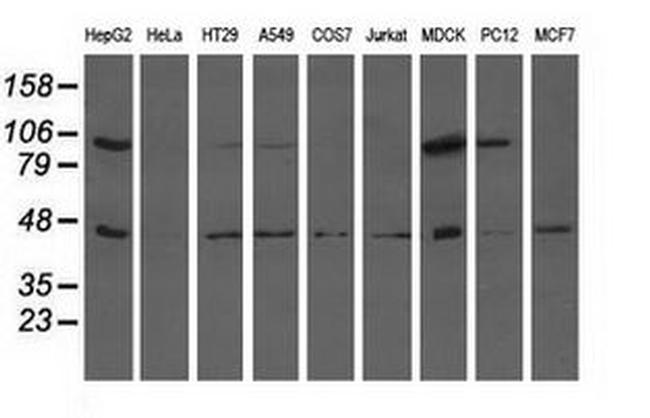 ALDH1L1 Antibody in Western Blot (WB)