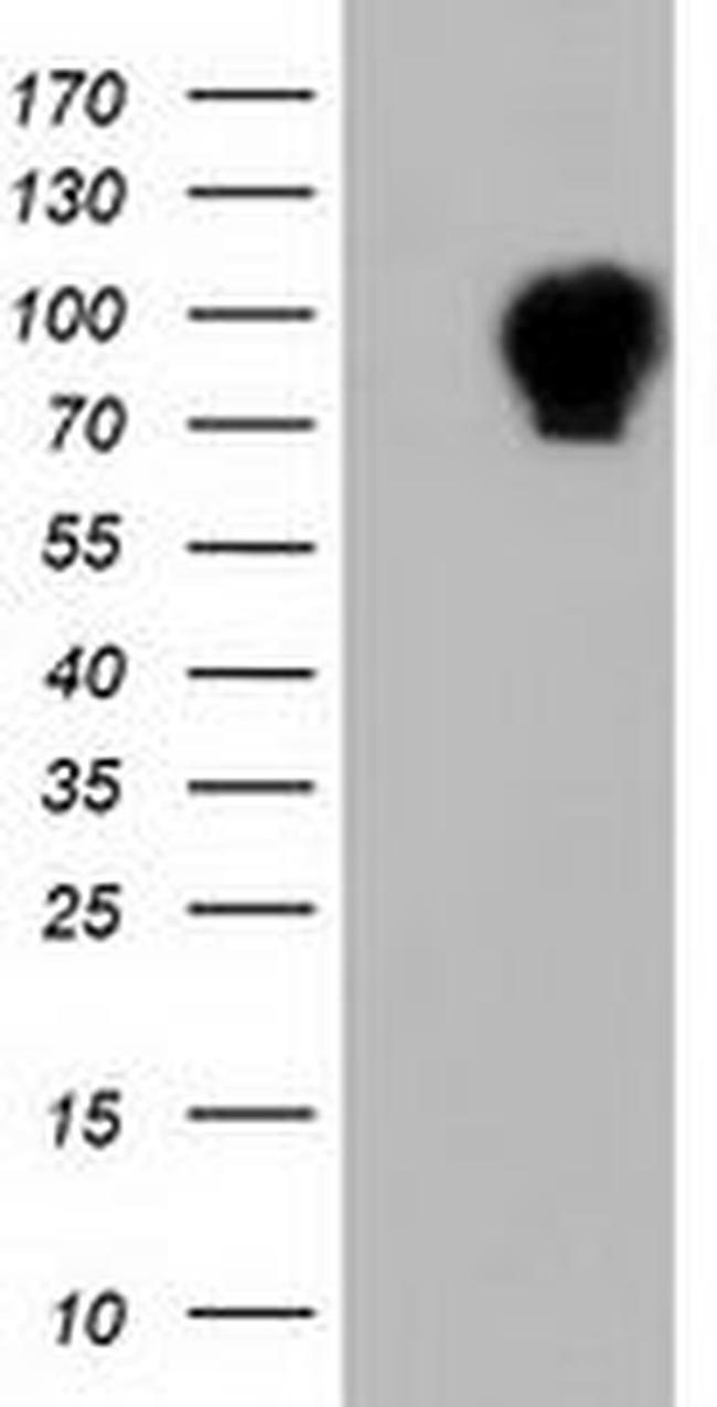 ALDH1L1 Antibody in Western Blot (WB)