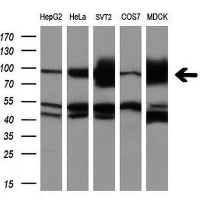 ALDH1L1 Antibody in Western Blot (WB)