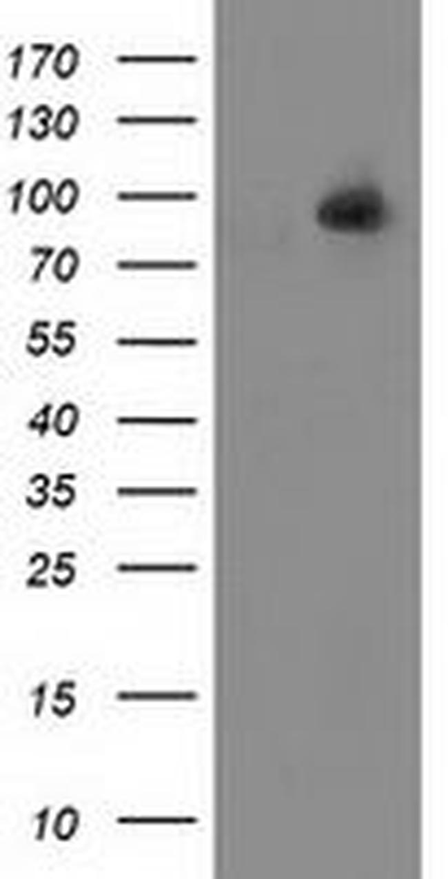 ALDH1L1 Antibody in Western Blot (WB)