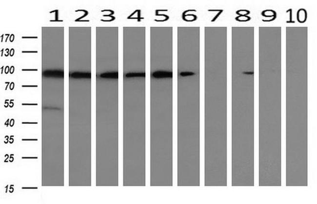 ALDH1L1 Antibody in Western Blot (WB)