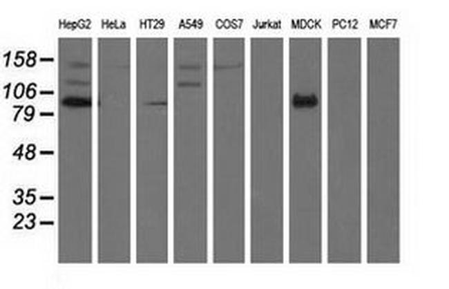 ALDH1L1 Antibody in Western Blot (WB)