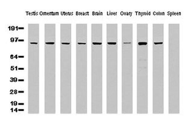 ALDH1L1 Antibody in Western Blot (WB)