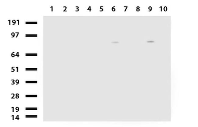 ALDH1L1 Antibody in Western Blot (WB)