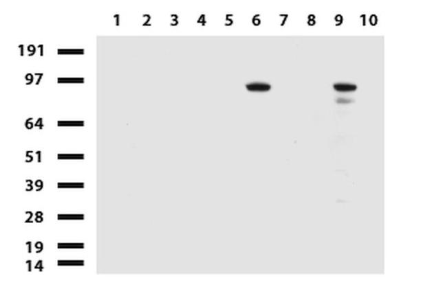 ALDH1L1 Antibody in Western Blot (WB)