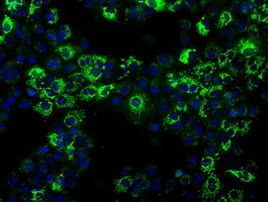 ALDH2 Antibody in Immunocytochemistry (ICC/IF)