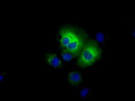 ALDH3A1 Antibody in Immunocytochemistry (ICC/IF)