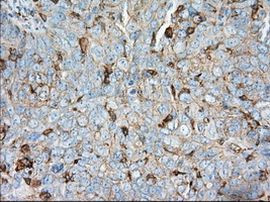 ALDH3A1 Antibody in Immunohistochemistry (Paraffin) (IHC (P))