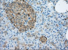 ALDH3A1 Antibody in Immunohistochemistry (Paraffin) (IHC (P))