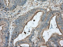 ALDH3A1 Antibody in Immunohistochemistry (Paraffin) (IHC (P))