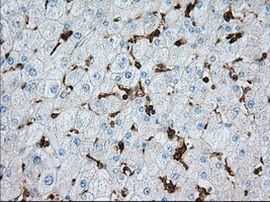 ALDH3A1 Antibody in Immunohistochemistry (Paraffin) (IHC (P))